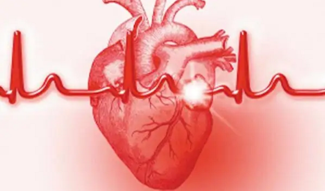 心梗的诱发原因有哪些，心肌梗死急救常识一定要知道