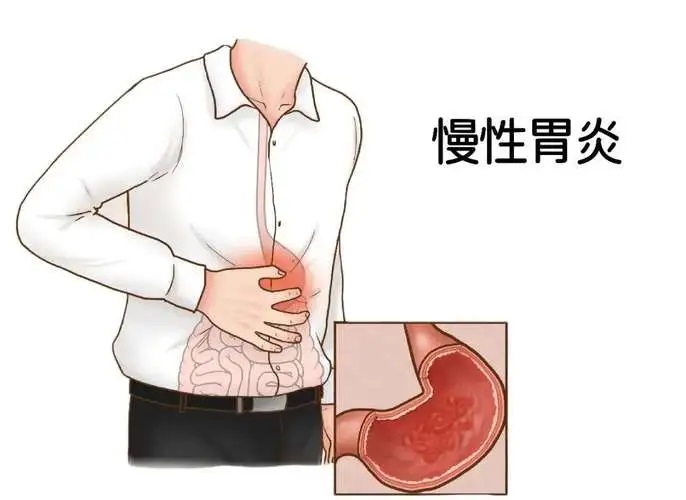 慢性肠胃炎吃什么能恢复正常,慢性胃炎好治吗？