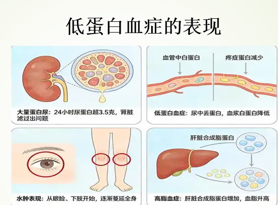 低蛋白血症是什么病,人参牛骨髓肽对低蛋白血症有好处吗?